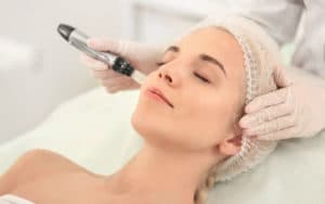 Micro-Needling at Soma Laser Pretoria