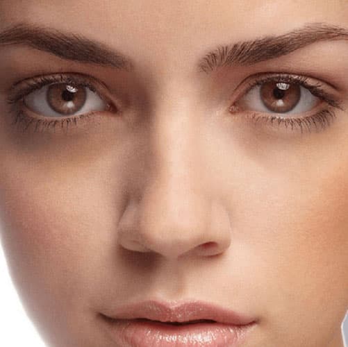 Eye: Dark Circles