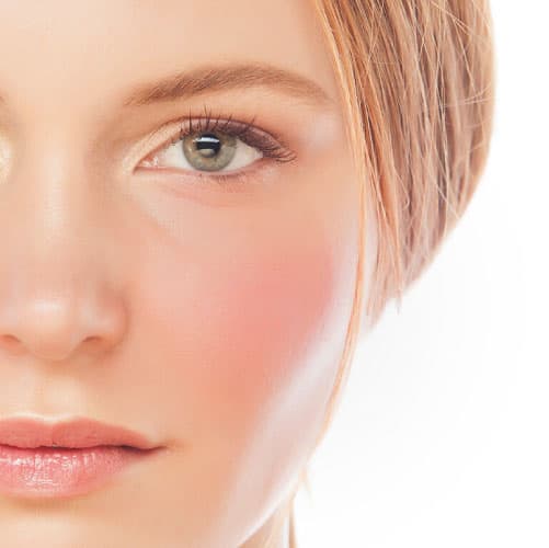 Sensitive / Thin / Rosacea (Redness) Prone Skin