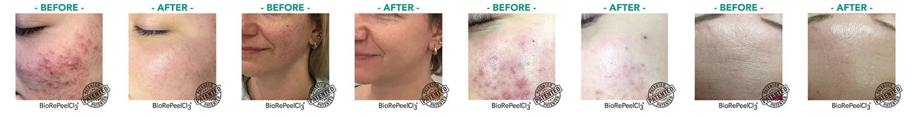 before and after