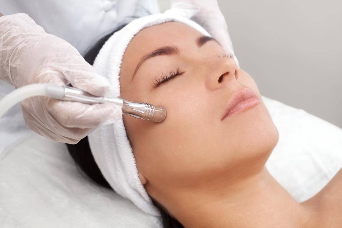 microdermabrasion - somalaser and skincare clinic microdermabrasion - somalaser and skincare clinic