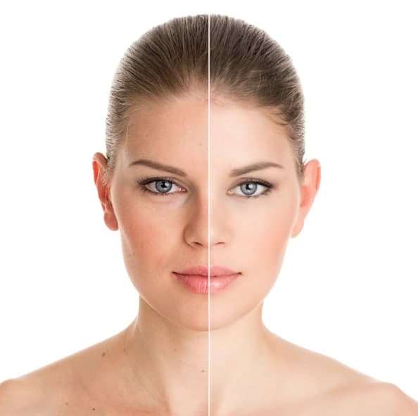 skin-rejuvenation-info What is Skin Rejuvenation?