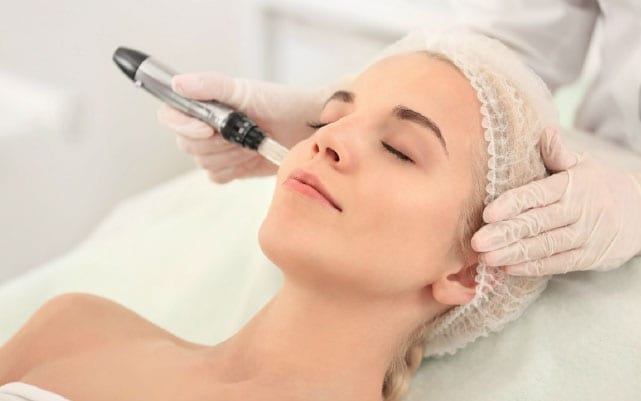 Micro-Needling at Soma Laser Pretoria
