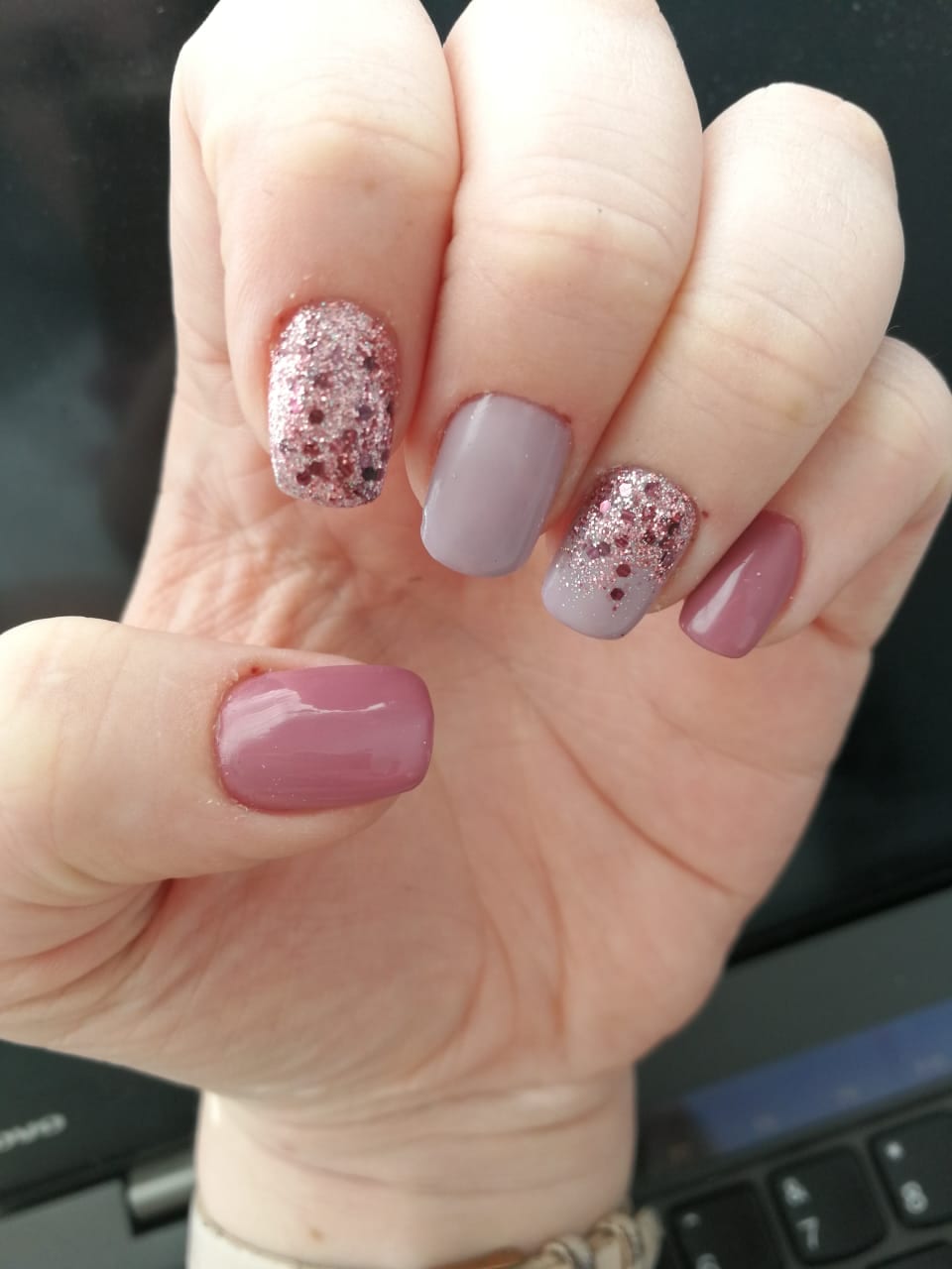 Nails - Soma Laser - Skincare clinic - Pretoria - Customised skin and hair treatments. Stockists of Dermalogica, Lamelle, MD Lash Factor and Heliocare
