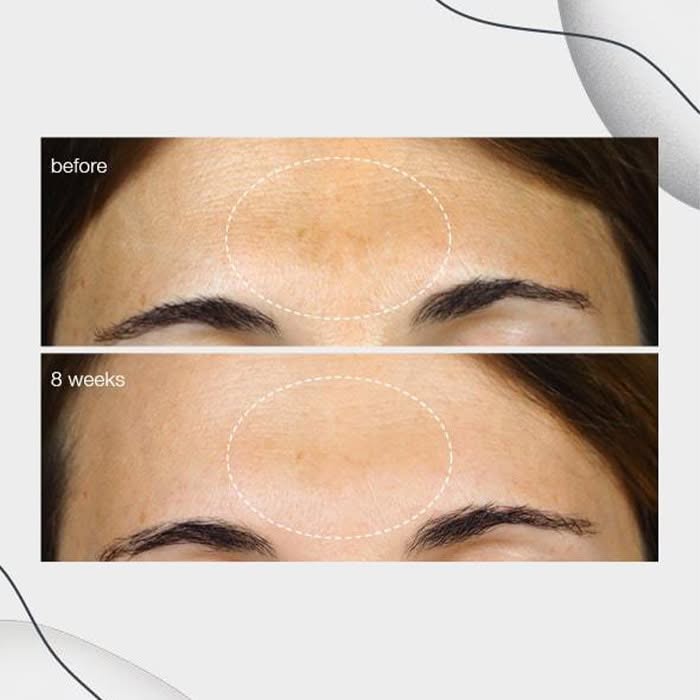 111404.e - Soma Laser - Skincare clinic - Pretoria - Customised skin and hair treatments. Stockists of Dermalogica, Lamelle, MD Lash Factor and Heliocare