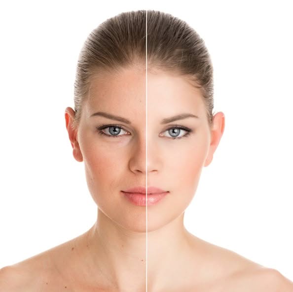 What is Skin Rejuvenation?